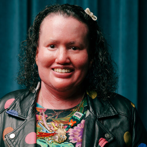 Carly Findlay standing in front of a blue curtain. 